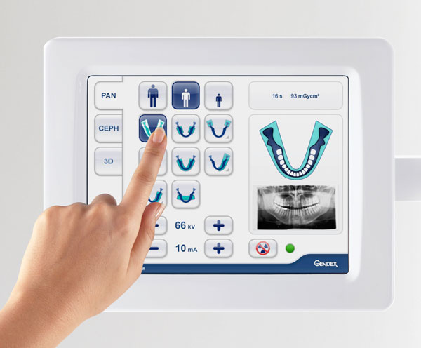 Ортопантомограф для получения панорамных снимков зубов (стоматология в Химках)