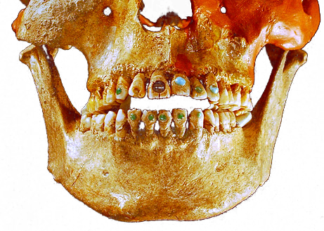 Зубные украшения которым 2500 лет