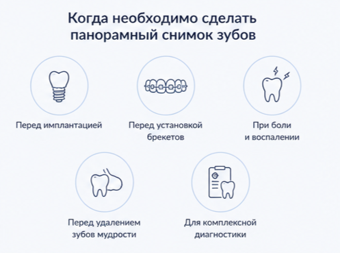 Ортопантомограф Gendex GXDP -700 3D (Стоматология Сити Смайл в Химках)